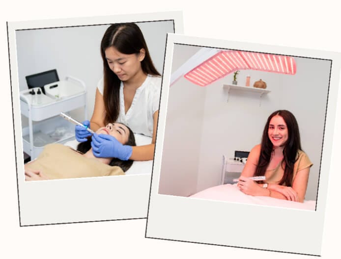 Two images: a woman performing  microneedling on another woman, and a  headshot of a female staff member