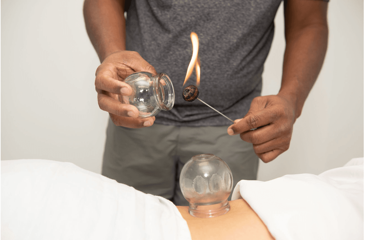Fire Cupping